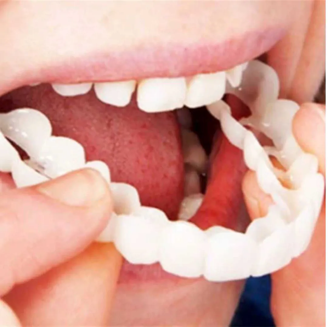 CARILLAS DENTALES: Sonríe con Confianza - CARILLAS DENTALES