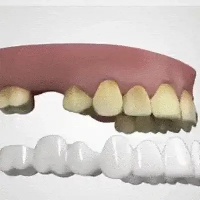 CARILLAS DENTALES: Sonríe con Confianza