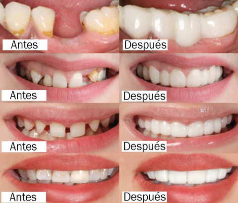 Resultados Increíbles
