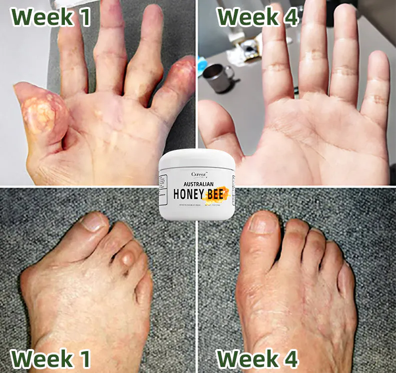 HONEY BEE POMADA: Alivio del Dolor Articular y Regeneración Ósea - HONEY BEE POMADA