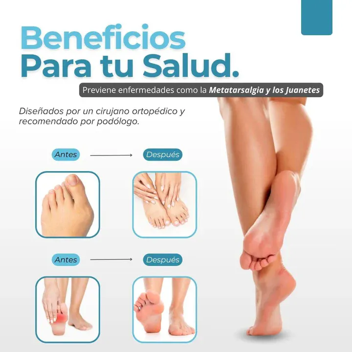 Almohadilla Plantilla Silicona Antepie BioFlex Confort™: ¡Adiós al Dolor de Pies y Piernas! - Almohadilla Plantilla Silicona Antepie