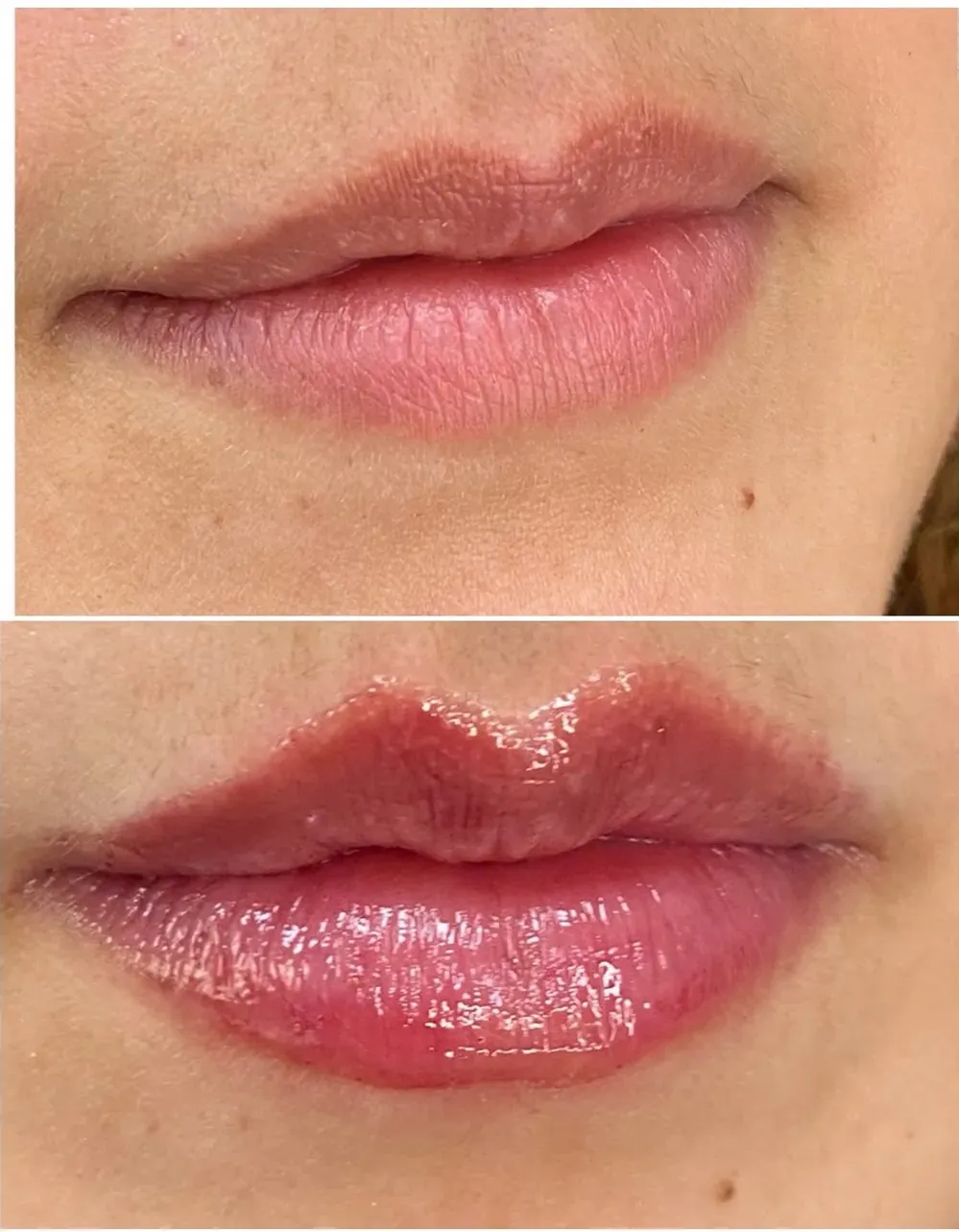 VOLUMINIZADOR DE LABIOS X2 UNIDADES: Labios Más Voluminosos y Sensuales - VOLUMINIZADOR DE LABIOS  X2 UNIDADES