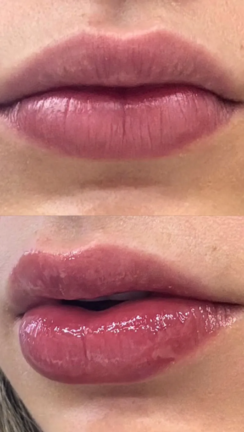 Cómo Usar el Voluminizador de Labios