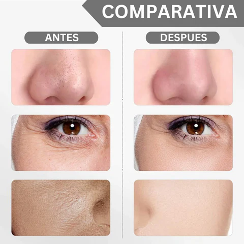 Unifica tu Tonos de Piel y Reduce las Arrugas