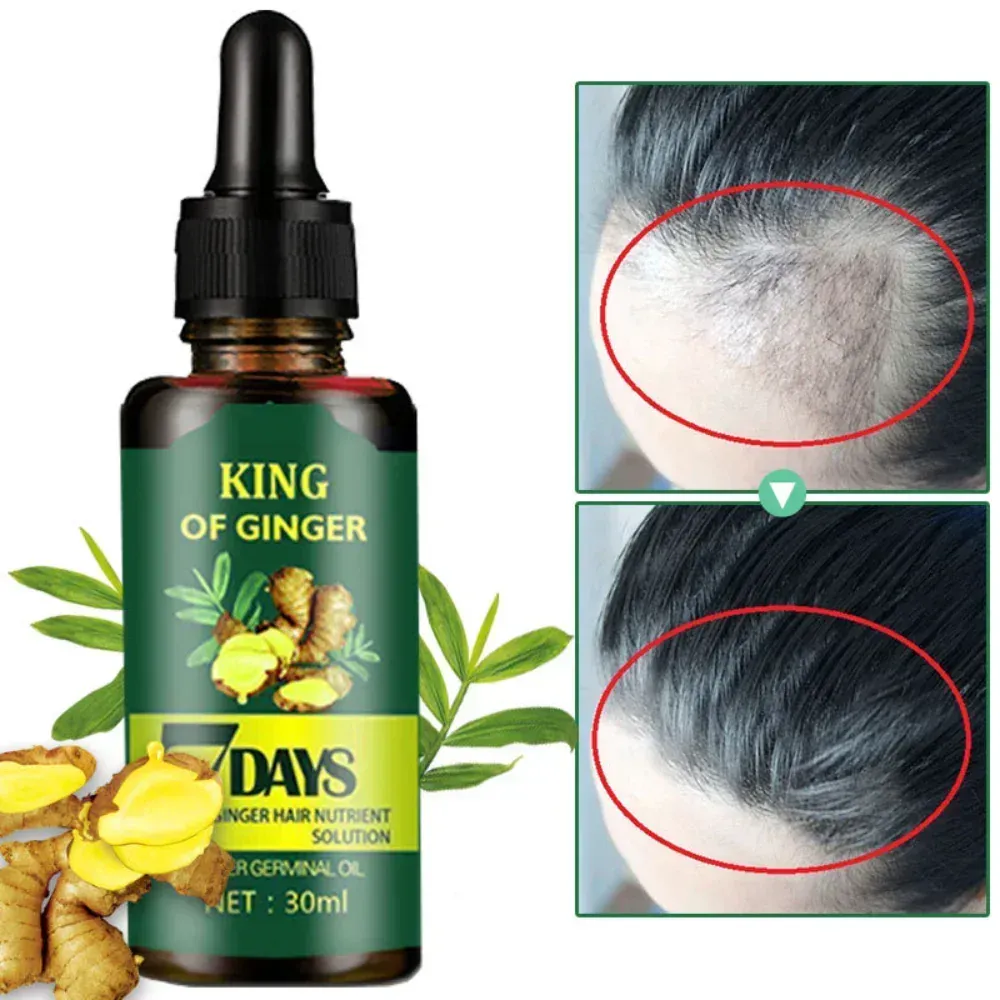 KING OF GINGER: ¡El secreto para un cabello y una barba más exuberantes! - KING OF GINGER CRECER EL PELO Y BARBA